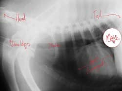 Lung Mass 2